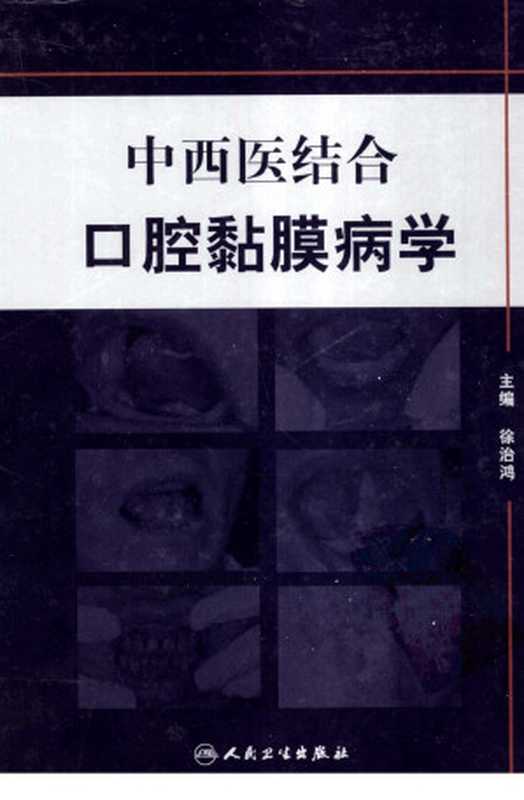 中西医结合口腔粘膜病学（徐治鸿主编）