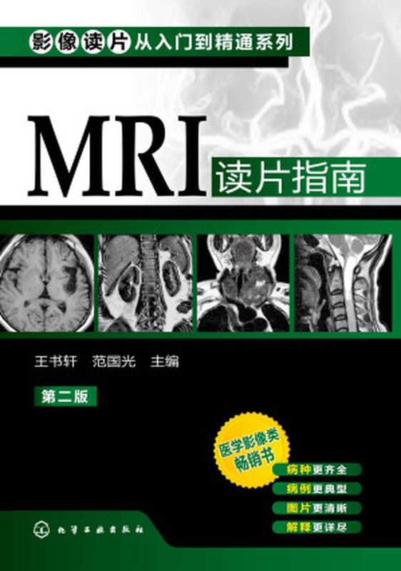 MRI读片指南 (影像读片从入门到精通系列)(王书轩、范国光 主编)(化学工业出版社 2013)