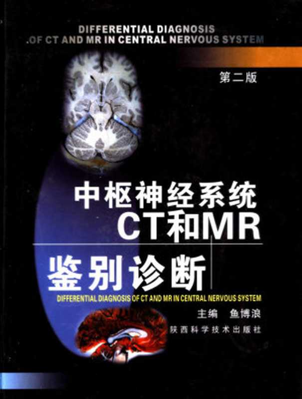 中枢神经系统CT和MR鉴别诊断（鱼博浪主编；张明 梁星原副主编；王斐 孙亲利 孙静 宋晓彬 罗琳 范帆 郭世萍）（Shaanxi Science and Technology Press 2021）