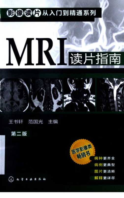 MRI读片指南（王书轩 范国光主编）