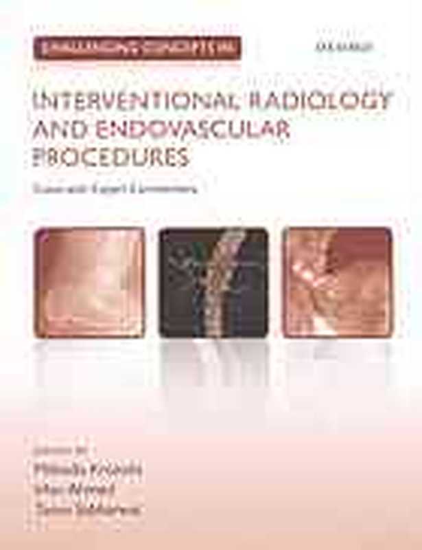 ChallengingConceptsInInterventionalRadiologyAndEndovascularProceduresCasesWithExpertCommentary（MiltiadisKrokidisIrfanAhmedTarunSabharwal）（OxfordUniversityPress2015）