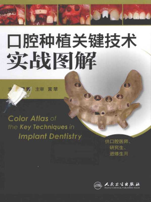 口腔种植关键技术实战图解(谭震著)(人民卫生出版社)