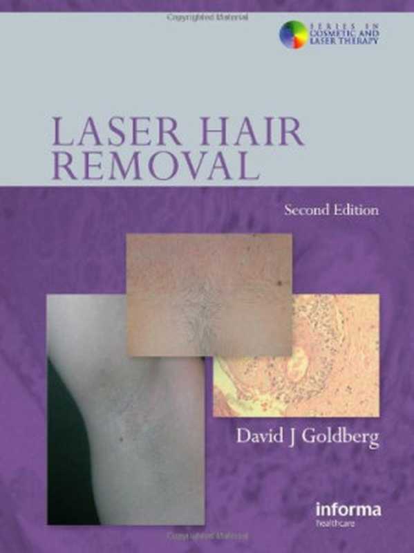LaserHairRemovalSecondEdition(SeriesinCosmeticandLaserTherapy)（DavidJ.Goldberg）（InformaHealthcare2008）