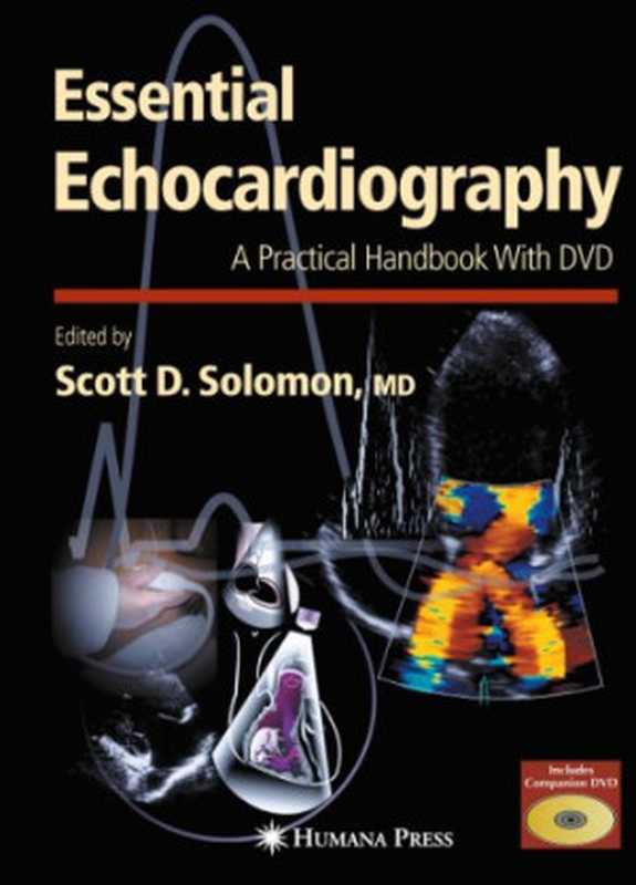EssentialEchocardiographyAPracticalHandbook(ContemporaryCardiology)(ScottD.Solomon)(Humana2006)